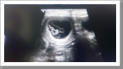 das 1. Bild der neuen Welpen